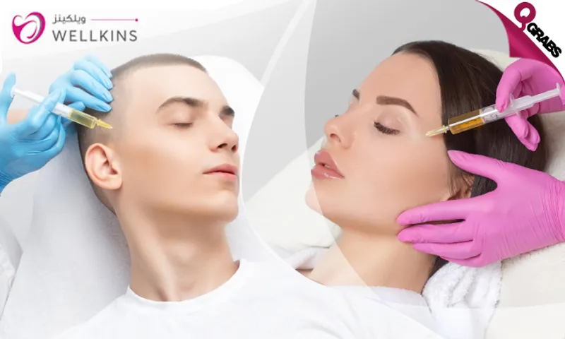 Dermapen & PRP Sessions for Ladies & Men!